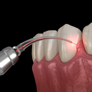 Dental Pharma Products